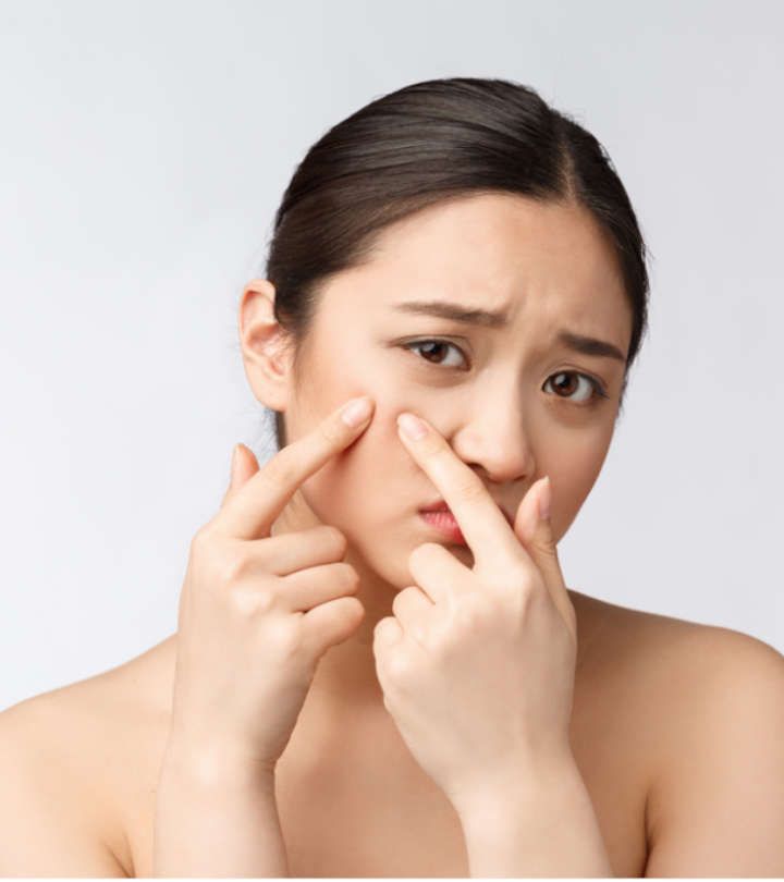 The Ultimate Guide to Stopping Acne Breakouts