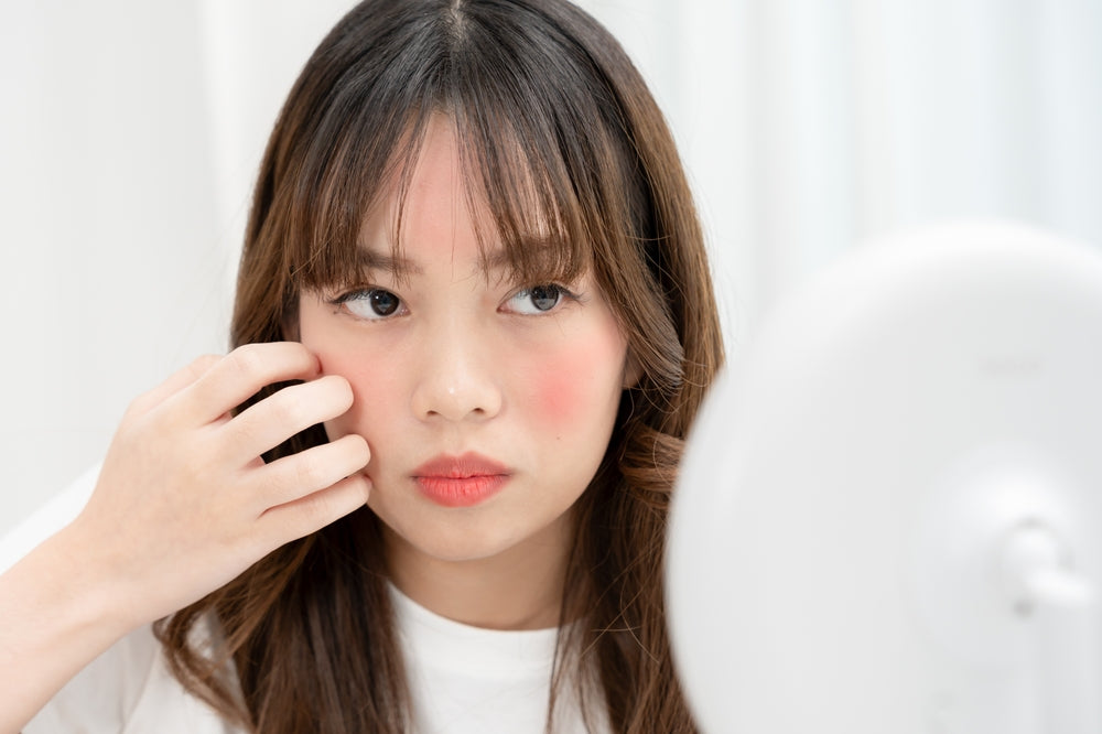 Rosacea: Treating Skin with Gradient Care